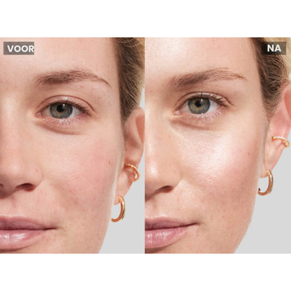 MicroLift Pro voordelen – microstroom, red light en serum-infusie – ElleCera