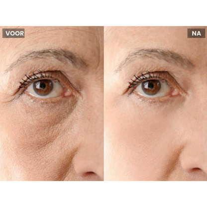 MicroLift Pro gebruik bij de kaaklijn – lifting thuis – ElleCera