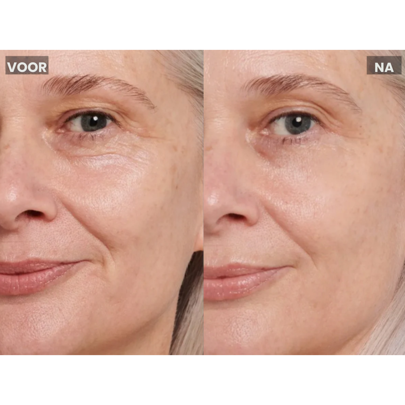 MicroLift Pro verpakking – microstroom facelift-apparaat – ElleCera