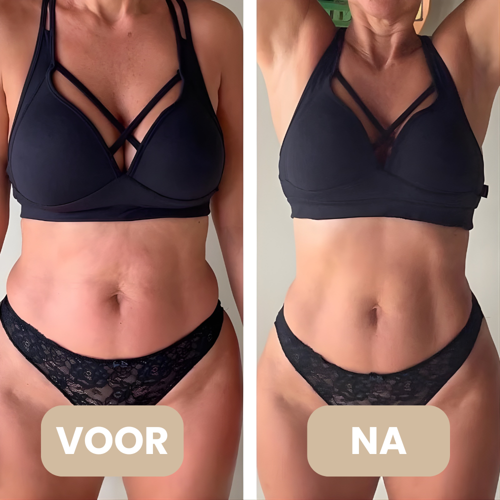 DermaSculpt voor en na – minder cellulite en gladdere huid – ElleCera