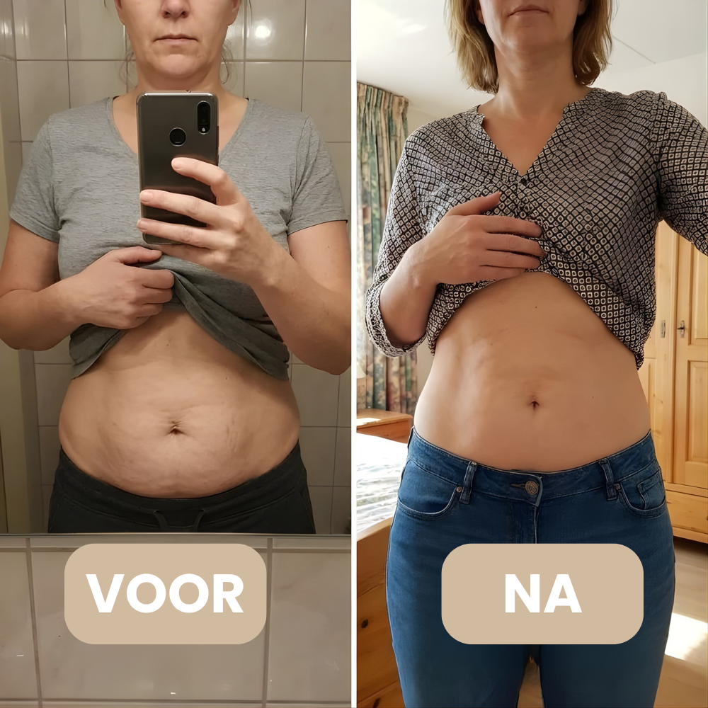 DermaSculpt resultaat – strakkere huid en minder sinaasappelhuid – ElleCera