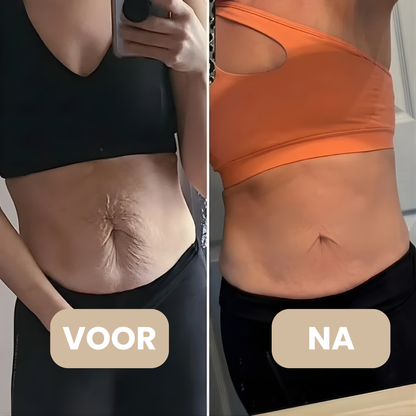 DermaSculpt gebruik op billen – cellulite verminderen thuis – ElleCera