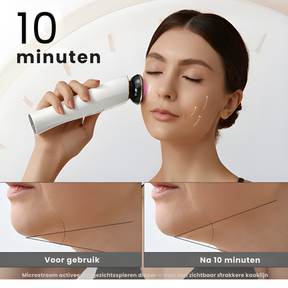 MicroLift Pro resultaat – stevigere huid en scherpere kaaklijn – ElleCera