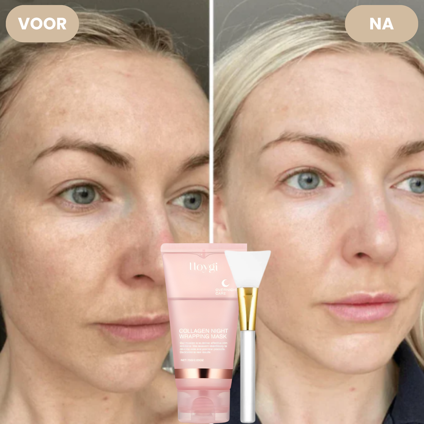 GlowWrap resultaat – gladdere en vollere huid – ElleCera