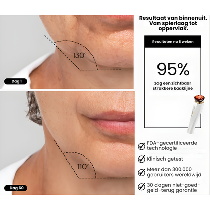 MicroLift Pro Red Light Therapy detail – collageenstimulatie – ElleCera