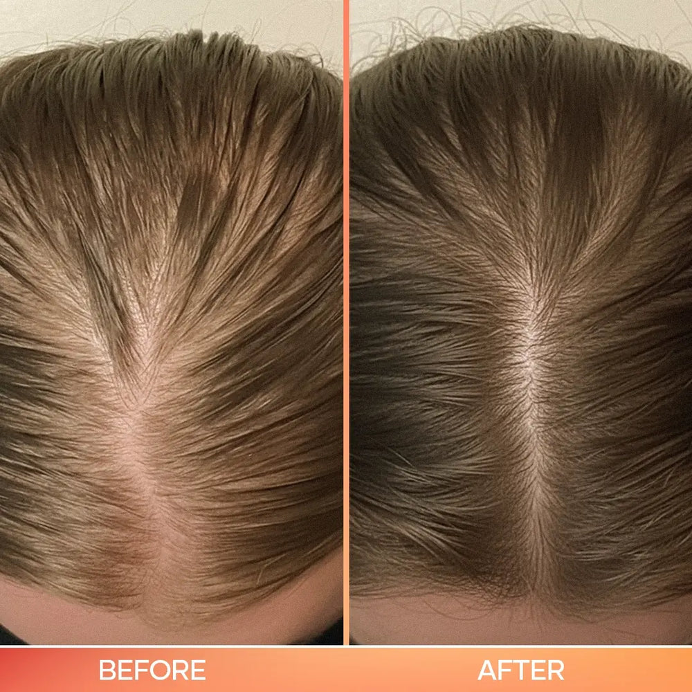 3-in-1 hair scalp tool voor en na – gezondere hoofdhuid en meer haargroei – ElleCera