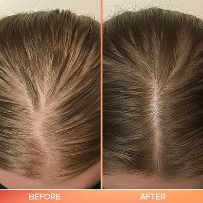 3-in-1 hair scalp tool voor en na – gezondere hoofdhuid en meer haargroei – ElleCera