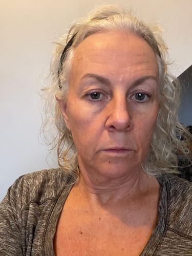 Klantreview Micro-Infusion Skin System – positieve ervaring thuis – ElleCera
