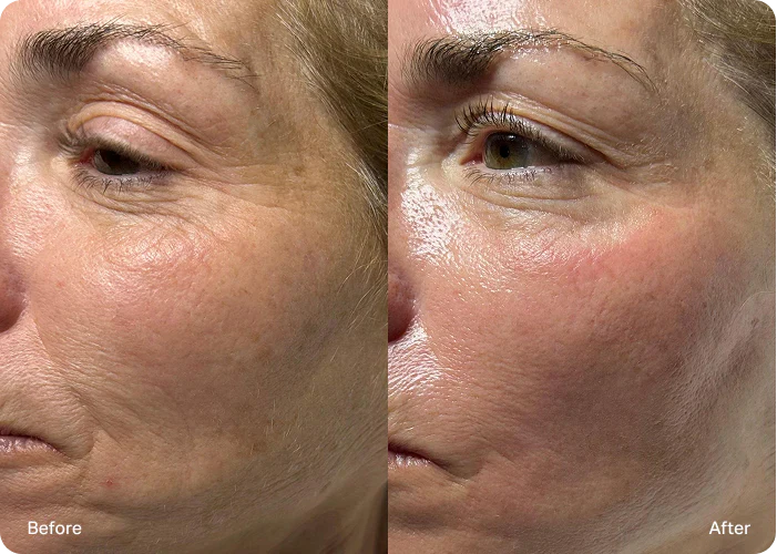 Klantreview SilkPeptide Ampoule – verrast door zichtbaar resultaat lifting serum – ElleCera